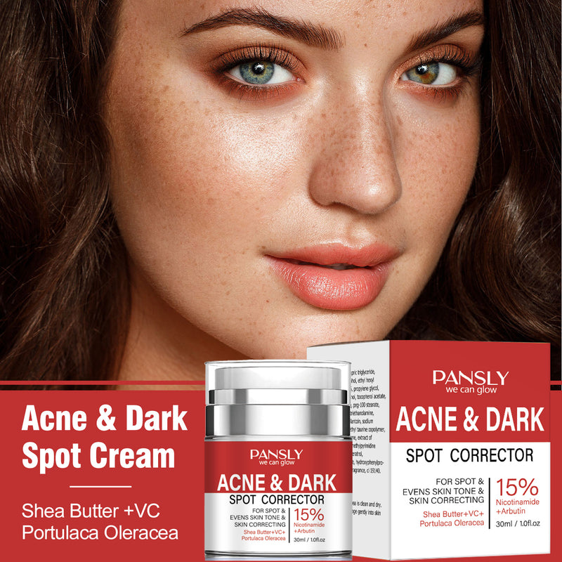 Strong Removal Melasma Whitening Dark Acne Spot Corrector Cream Freckle Sunburn