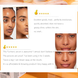Brightening Turmeric Face Serum Clear Skin Acne Dark Spots Whitening Nourishing