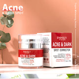 Strong Removal Melasma Whitening Dark Acne Spot Corrector Cream Freckle Sunburn