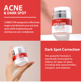 Strong Removal Melasma Whitening Dark Acne Spot Corrector Cream Freckle Sunburn