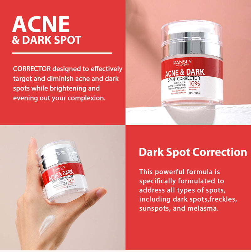 Strong Removal Melasma Whitening Dark Acne Spot Corrector Cream Freckle Sunburn