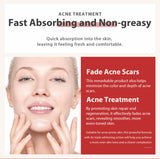Strong Removal Melasma Whitening Dark Acne Spot Corrector Cream Freckle Sunburn