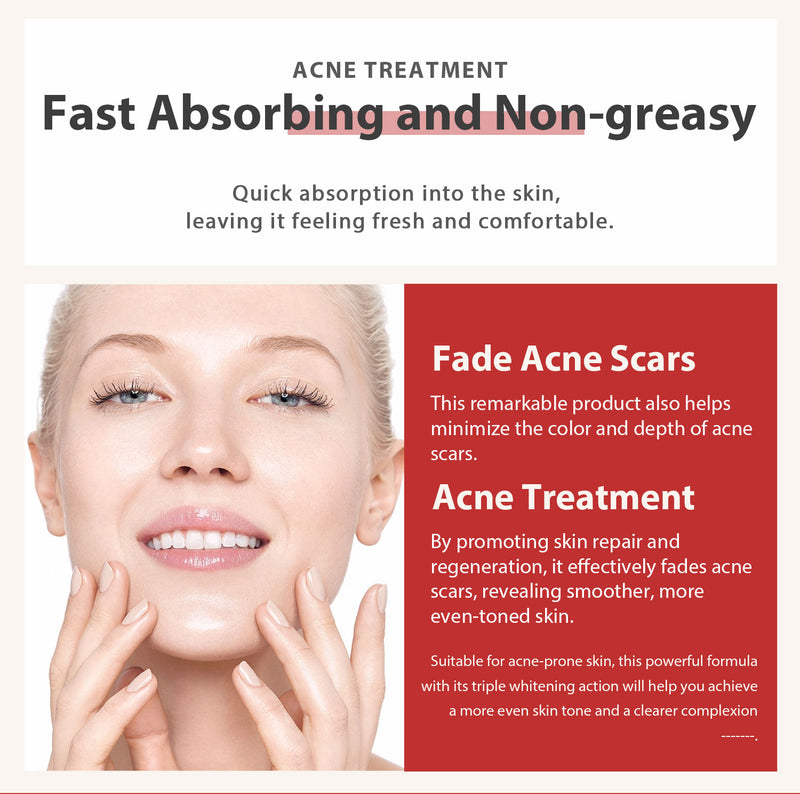 Strong Removal Melasma Whitening Dark Acne Spot Corrector Cream Freckle Sunburn