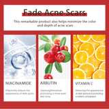 Strong Removal Melasma Whitening Dark Acne Spot Corrector Cream Freckle Sunburn