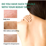 Body Acne Spray Back Acne Treatment 100ml 2% Salicylic Acid Clear Spots